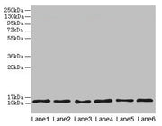 Western blot All lanes: TCTA antibody at 1.6µg/ml Lane 1: Mouse liver tissue Lane 2: Mouse gonadal tissue Lane 3: Mouse muscle tissue Lane 4: HL60 whole cell lysate Lane 5: U251 whole cell lysate Lane 6: MCF-7 whole cell lysate Secondary Goat poly...