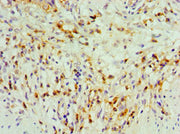 Immunohistochemistry of paraffin-embedded human gallbladder tissue using CSB-PA023343ESR1HU at dilution of 1:100