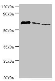 Western blot All lanes: Tyrosyl-DNA phosphodiesterase 1 antibody at 8ug/ml Lane 1: MCF-7 whole cell lysate Lane 2: Mouse lung tissue Lane 3: Rat brain tissue Secondary Goat polyclonal to rabbit IgG at 1/10000 dilution Predicted band size: 69, 42 k...