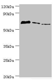 Western blot All lanes: Tyrosyl-DNA phosphodiesterase 1 antibody at 8ug/ml Lane 1: MCF-7 whole cell lysate Lane 2: Mouse lung tissue Lane 3: Rat brain tissue Secondary Goat polyclonal to rabbit IgG at 1/10000 dilution Predicted band size: 69, 42 k...