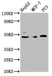 Western Blot Positive WB detected in: HepG2 whole cell lysate, MCF-7 whole cell lysate, PC-3 whole cell lysate All lanes: TEAD1 antibody at 3.6µg/ml Secondary Goat polyclonal to rabbit IgG at 1/50000 dilution Predicted band size: 48 kDa Observed b...