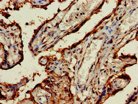 Immunohistochemistry of paraffin-embedded human placenta tissue using CSB-PA023386EA01HU at dilution of 1:100