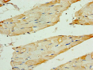 Immunohistochemistry of paraffin-embedded human skeletal muscle tissue using CSB-PA023386ESR1HU at dilution of 1:100