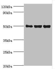 Western blot All lanes: TERF1 antibody at 2ug/ml Lane 1: k562 whole cell lysate Lane 2: 293T whole cell lysate Lane 3: Jurkat whole cell lysate Secondary Goat polyclonal to rabbit IgG at 1/10000 dilution Predicted band size: 51, 49 kDa Observed ba...