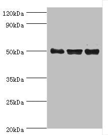 Western blot All lanes: TERF1 antibody at 2ug/ml Lane 1: k562 whole cell lysate Lane 2: 293T whole cell lysate Lane 3: Jurkat whole cell lysate Secondary Goat polyclonal to rabbit IgG at 1/10000 dilution Predicted band size: 51, 49 kDa Observed ba...