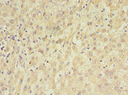 Immunohistochemistry of paraffin-embedded human liver tissue using CSB-PA023398LA01HU at dilution of 1:100