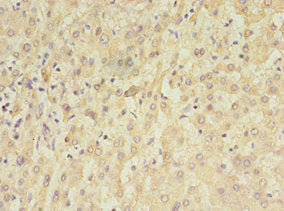 Immunohistochemistry of paraffin-embedded human liver tissue using CSB-PA023398LA01HU at dilution of 1:100