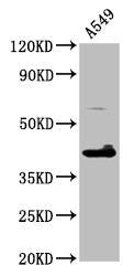 Western Blot Positive WB detected in: A549 whole cell lysate All lanes: TFB1M antibody at 4.6µg/ml Secondary Goat polyclonal to rabbit IgG at 1/50000 dilution Predicted band size: 40 kDa Observed band size: 40 kDa