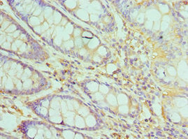 Immunohistochemistry of paraffin-embedded human colon tissue using CSB-PA023424ESR1HU at dilution of 1:100