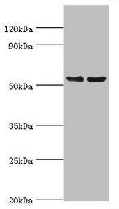 Western blot All lanes: Transcription factor EB antibody at 3ug/ml Lane 1: Jurkat whole cell lysate Lane 2: Mouse brain tissue Secondary Goat polyclonal to rabbit IgG at 1/10000 dilution Predicted band size: 53, 44 kDa Observed band size: 53 kDa