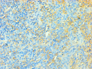 Immunohistochemistry of paraffin-embedded human tonsil tissue using CSB-PA023429ESR2HU at dilution of 1:100
