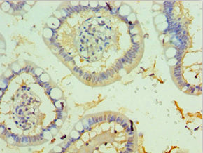 Immunohistochemistry of paraffin-embedded human small intestine tissue using CSB-PA023432ESR2HU at dilution of 1:100