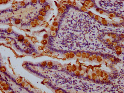 IHC image of CSB-PA023433LA01HU diluted at 1:1000 and staining in paraffin-embedded human small intestine tissue performed on a Leica BondTM system. After dewaxing and hydration, antigen retrieval was mediated by high pressure in a citrate buffer...