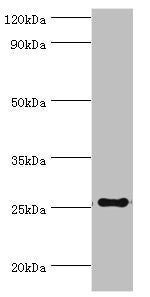 Western blot All lanes: factor pathway inhibitor 2 antibody at 4ug/ml + Mouse liver tissue Secondary Goat polyclonal to rabbit IgG at 1/10000 dilution Predicted band size: 27, 26 kDa Observed band size: 27 kDa