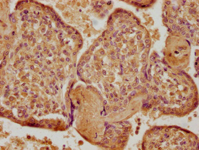 IHC image of CSB-PA023438LA01HU diluted at 1:400 and staining in paraffin-embedded human placenta tissue performed on a Leica BondTM system. After dewaxing and hydration, antigen retrieval was mediated by high pressure in a citrate buffer (pH 6.0)...