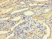 Immunohistochemistry of paraffin-embedded human kidney tissue using CSB-PA023449LA01HU at dilution of 1:100