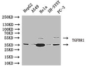 Western Blot Positive WB detected in: HepG2 whole cell lysate, A549 whole cell lysate, Hela whole cell lysate, SH-SY5Y, PC-3 whole cell lysate All lanes: TGFBR1 antibody at 1:1000 Secondary Goat polyclonal to rabbit IgG at 1/50000 dilution Predict...