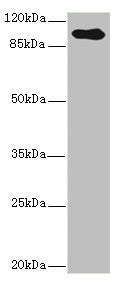 Western blot All lanes: TGFBR3 antibody IgG at 2.39ug/ml + Hela whole cell lysate Secondary Goat polyclonal to rabbit IgG at 1/10000 dilution Predicted band size: 93 kDa Observed band size: 93 kDa