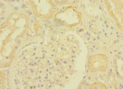 Immunohistochemistry of paraffin-embedded human kidney tissue using CSB-PA023453ESR2HU at dilution of 1:100