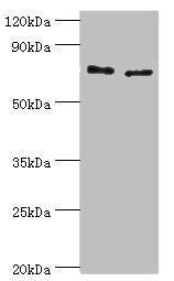 Western blot All lanes: Protein-glutamine gamma-glutamyltransferase 2 antibody at 8ug/ml Lane 1: Hela whole cell lysate Lane 2: HepG2 whole cell lysate Secondary Goat polyclonal to rabbit IgG at 1/10000 dilution Predicted band size: 78, 62, 39 kDa...