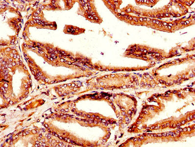 IHC image of CSB-PA023464LA01HU diluted at 1:300 and staining in paraffin-embedded human prostate tissue performed on a Leica BondTM system. After dewaxing and hydration, antigen retrieval was mediated by high pressure in a citrate buffer (pH 6.0)...