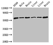 Western Blot Positive WB detected in: A549 whole cell lysate, Hela whole cell lysate, Rat brain tissue, Rat liver tissue, Mouse liver tissue, Mouse brain tissue All lanes: TH antibody at 4ug/ml Secondary Goat polyclonal to rabbit IgG at 1/50000 di...