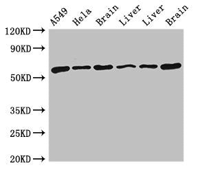 Western Blot Positive WB detected in: A549 whole cell lysate, Hela whole cell lysate, Rat brain tissue, Rat liver tissue, Mouse liver tissue, Mouse brain tissue All lanes: TH antibody at 4ug/ml Secondary Goat polyclonal to rabbit IgG at 1/50000 di...
