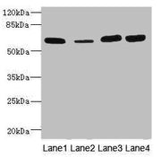 Western blot All lanes: THBD antibody at 3.07µg/ml Lane 1: Rat heart tissue Lane 2: Mouse kidney tissue Lane 3: A549 whole cell lysate Lane 4: A431 whole cell lysate Secondary Goat polyclonal to rabbit IgG at 1/10000 dilution Predicted band size:...