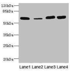 Western blot All lanes: THBD antibody at 3.07µg/ml Lane 1: Rat heart tissue Lane 2: Mouse kidney tissue Lane 3: A549 whole cell lysate Lane 4: A431 whole cell lysate Secondary Goat polyclonal to rabbit IgG at 1/10000 dilution Predicted band size:...