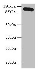 Western blot All lanes: Thbs3 antibody at 16µg/ml + HepG2 whole cell lysate Secondary Goat polyclonal to rabbit IgG at 1/10000 dilution Predicted band size: 105 kDa Observed band size: 105 kDa