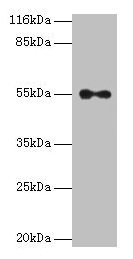 Western blot All lanes: THRA antibody at 2µg/ml + A431 whole cell lysate Secondary Goat polyclonal to rabbit IgG at 1/10000 dilution Predicted band size: 55, 47, 51 kDa Observed band size: 55 kDa