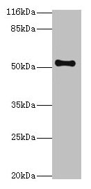 Western blot All lanes: THRB antibody at 2µg/ml + Mouse liver tissue Secondary Goat polyclonal to rabbit IgG at 1/10000 dilution Predicted band size: 53, 55 kDa Observed band size: 53 kDa