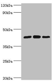 Western blot All lanes: Nucleolysin TIA-1 isoform p40 antibody at 2ug/ml Lane 1: Jurkat whole cell lysate Lane 2: K562 whole cell lysate Lane 3: Hela whole cell lysate Secondary Goat polyclonal to rabbit IgG at 1/10000 dilution Predicted band size...