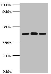 Western blot All lanes: Nucleolysin TIA-1 isoform p40 antibody at 2ug/ml Lane 1: Jurkat whole cell lysate Lane 2: K562 whole cell lysate Lane 3: Hela whole cell lysate Secondary Goat polyclonal to rabbit IgG at 1/10000 dilution Predicted band size...