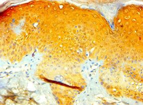 Immunohistochemistry of paraffin-embedded human skin tissue using CSB-PA023528ESR1HU at dilution of 1:100