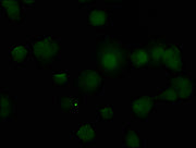 Immunofluorescence staining of MCF-7 cells with CSB-PA023529HA01HU at 1:50, counter-stained with DAPI. The cells were fixed in 4% formaldehyde, permeabilized using 0.2% Triton X-100 and blocked in 10% normal Goat Serum. The cells were then incubat...