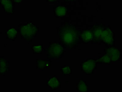 Immunofluorescence staining of MCF-7 cells with CSB-PA023529HA01HU at 1:50, counter-stained with DAPI. The cells were fixed in 4% formaldehyde, permeabilized using 0.2% Triton X-100 and blocked in 10% normal Goat Serum. The cells were then incubat...