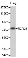 Western blot analysis of lung cell lysate using TICAM1 antibody.