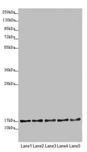 Western blot All lanes: TIMM17B antibody at 1.75 ug/ml Lane 1: U251 whole cell lysate Lane 2: Jurkat whole cell lysate Lane 3: HepG2 whole cell lysate Lane 4: HL60 whole cell lysate Lane 5: A431 whole cell lysate Secondary Goat polyclonal to rabbi...