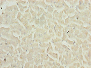 Immunohistochemistry of paraffin-embedded human heart tissue using CSB-PA023560YA01HU at dilution of 1:100