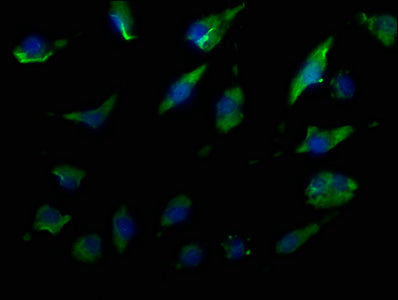 Immunofluorescence staining of U251 cells with CSB-PA023573OA01HU at 1:50, counter-stained with DAPI. The cells were fixed in 4% formaldehyde, permeabilized using 0.2% Triton X-100 and blocked in 10% normal Goat Serum. The cells were then incubate...