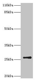 Western blot All lanes: TK1 antibody at 2µg/ml + CEM whole cell lysate Secondary Goat polyclonal to rabbit IgG at 1/10000 dilution Predicted band size: 26 kDa Observed band size: 26 kDa