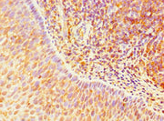 Immunohistochemistry of paraffin-embedded human tonsil tissue using CSB-PA023600ESR2HU at dilution of 1:100