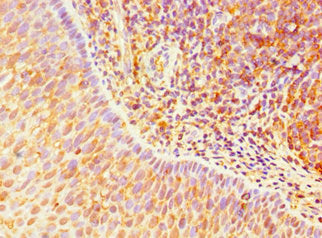 Immunohistochemistry of paraffin-embedded human tonsil tissue using CSB-PA023600ESR2HU at dilution of 1:100