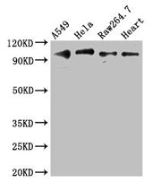 Western Blot Positive WB detected in: A549 whole cell lysate, Hela whole cell lysate, RAW264.7 whole cell lysate, Mouse heart tissue All lanes: TLR5 antibody at 3ug/ml Secondary Goat polyclonal to rabbit IgG at 1/50000 dilution Predicted band size...