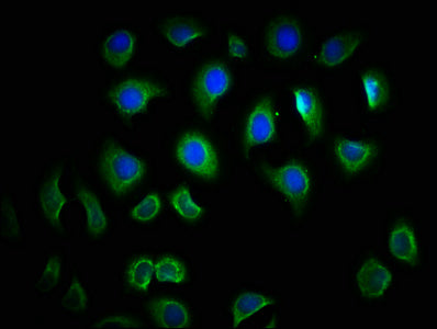 Immunofluorescence staining of A549 cells with CSB-PA023605LA01HU at 1:166, counter-stained with DAPI. The cells were fixed in 4% formaldehyde, permeabilized using 0.2% Triton X-100 and blocked in 10% normal Goat Serum. The cells were then incubat...