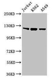 Western Blot Positive WB detected in: Jurkat whole cell lysate, K562 whole cell lysate, A549 whole cell lysate All lanes: Tlr7 antibody at 2µg/ml Secondary Goat polyclonal to rabbit IgG at 1/50000 dilution Predicted band size: 122 kDa Observed ban...