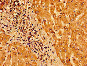 Immunohistochemistry of paraffin-embedded human liver tissue using CSB-PA023622LA01HU at dilution of 1:100