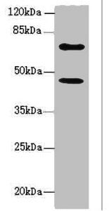 Western blot All lanes: TM9SF1 antibody at 6.93ug/ml + U251 whole cell lysate Secondary Goat polyclonal to rabbit IgG at 1/10000 dilution Predicted band size: 69, 56 kDa Observed band size: 69, 46 kDa