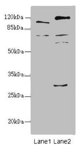 Western blot All lanes: TM9SF1 antibody at 2.18ug/ml Lane 1: Mouse liver tissue Lane 2: Mouse kidney tissue Secondary Goat polyclonal to rabbit IgG at 1/10000 dilution Predicted band size: 69, 56 kDa Observed band size: 69, 110, 59, 28 kDa